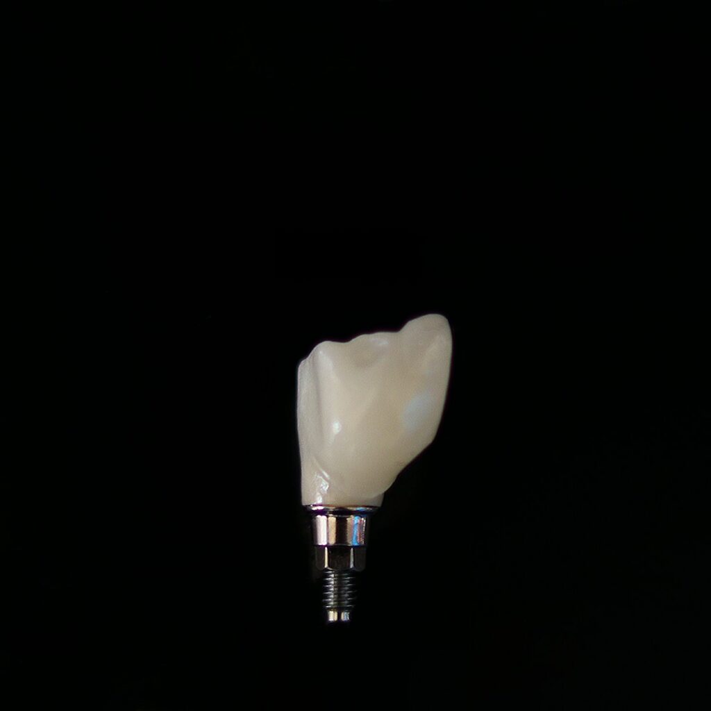 a tooth that is in the dark with a black background